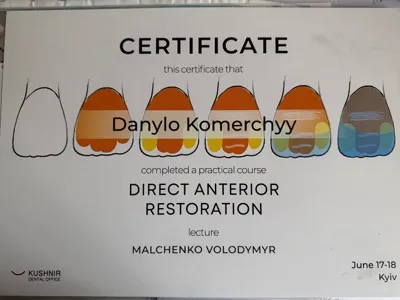 Сертифікат Kushnir Dental Office «Direct Anterior Restoration», лектор Malchenko Volodymyr, Київ